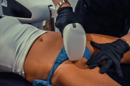 Laserontharing bikini te Leuven