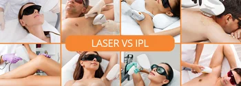 Laser versus IPL