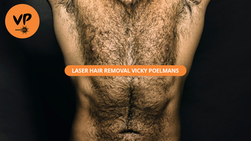 Permanent laser hair removal for men Leuven